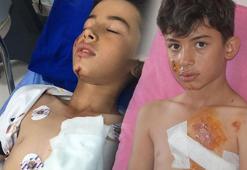11 yaşındaki Gürkan ölümden döndü! Kalbine yakın noktada 15 dikiş