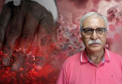 Yeni pandemi maymun çiçeği virüsü mü? Prof. Dr. Tevfik Özlü'den net cevap