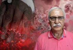 Yeni pandemi maymun çiçeği virüsü mü? Prof. Dr. Tevfik Özlü'den net cevap