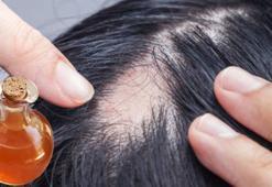 Kel bırakan saç kırana 20 dakikada çözüm! Meğer çok basitmiş, her evde var