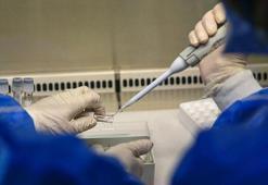 ABD gönderdi! Nijerya 10 bin doz M çiçeği aşısını teslim aldı