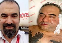 Pilotun ameliyatta ölümünde suç duyurusu!