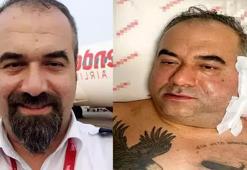 Pilotun ameliyatta ölümünde suç duyurusu!