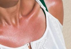 Açık tenliler risk altında! Bronzlaşırken sağlığınızdan olmayın