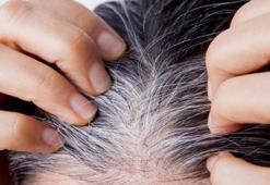 Beyaz teller canınızı sıkmasın! 2 su bardağına 1 tatlı kaşığı ekleyin, sonuç inanılmaz