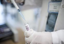 İskenderun Devlet Hastanesinde maymun çiçeği vakası görüldü iddiası için açıklama