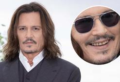 Dişlerinin hali olay olmuştu! Johnny Depp gülüşünü yeniledi