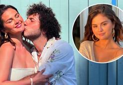 Selena Gomez çocuk sahibi olamayacağını açıkladı!  'Birçok sağlık sorunum var'