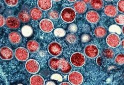 DSÖ’den maymun çiçeğine karşı ilk aşıya onay