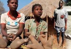 Deve kuşu gibi iki parmakları var! Köye gelenler korkarak baksa da avantaja çevirdiler