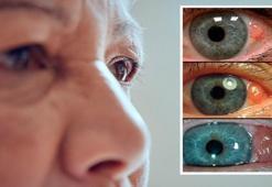 Basit bir apse sandı, gözünden oldu! Her gün daha da büyüyor: 'Rengine aldanmayın'