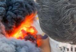 Saçları bitmek bilmeyen bombardımanda beyazladı! Ağlayarak anlattılar: 'Artık çocuk değiliz'