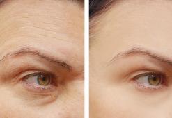 Güneş lekeleri dert olmasın! 10 dakikası yetiyor, bu yöntemleri deneyin