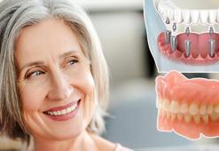 İmplant mı yoksa protez mi tercih edilmeli? Uzmanı son noktayı koydu