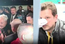 Beşiktaş Başkanı Hasan Arat'ın koruması Galatasaray muhabiri Emre Kaplan'ın burnunu kırdı!