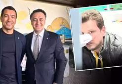 Emre Kaplan'a saldıran Sezgin Gülnar tahliye oldu! Beşiktaş'tan açıklama