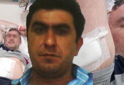 Kiracısını gündüz dövdü, gece bıçakladı! Ev sahibi için istenen ceza belli oldu
