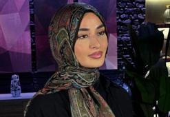 MASTERCHEF BEYZA'YA NE OLDU, YÜZÜ MÜ YANDI? MasterChef Beyza'nın son sağlık durumu nasıl?