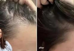 Sürmesi 1 dakikanızı bile almaz! Kellik problemini bitiriyor: 'Resmen saçımı yeniledi'
