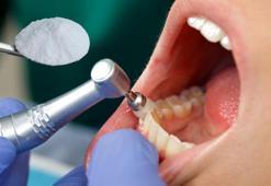 Taş dolu dişleri inci gibi yapan en doğal tüyo! Haftada 1 uygulayın, sonuç tertemiz