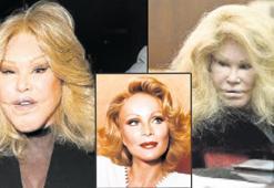 Doğallığın ölüm ilanı! Eşi yüzünden bu hale geldi