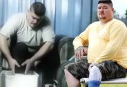 25 yıl kendi bacağından nefret etti! 'Bana ait değildi, bir gecede kopmasını diledim'