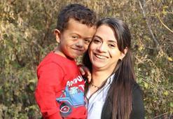 SKG ilacı karşıladı! 5 yaşındaki Selim'in boyu 11 ayda 8 santim uzadı