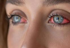 Kuru, yorgun, ağrılı gözlere neden oluyor! ‘Akşam saatlerinde maruz kalınmamalı’