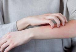 Ansızın gelen kaşıntıların sebebi beynimizin gönderdiği sinyaller mi?