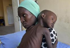 Nijerya'da kolera salgını: 25 ölü