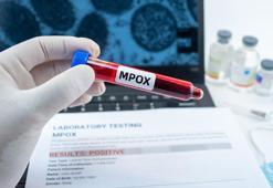 Nijerya'da, M çiçeği salgınına karşı aşılama kampanyası başlatıldı