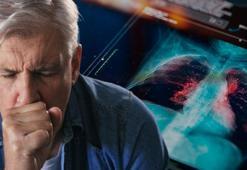400 milyon KOAH'lı var! Sabah öksürüğüyle sinyal veriyor: 'Elektronik sigara masum değil'
