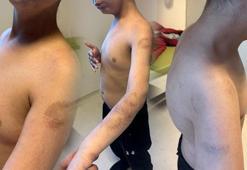 Otizmli çocuğa bakımevinde şiddet iddiası! 'Beğenmiyorsanız kendiniz baksaydınız'