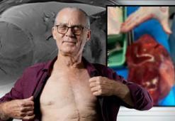 Aile hekimine gitti, 2 kilo tümörle çıktı! 'Hiçbir belirti yoktu, az kalsın ölecektim'