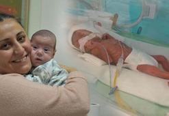 540 gram doğan Efe bebek annesine kavuştu