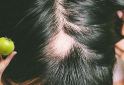 Kelliğe tek çare: Domates kabuğu! Kilit nokta rengiymiş, köklerden saç fışkıracak