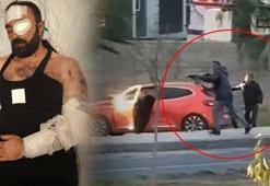 Silahlı kavgada yaralanan dernek başkanı: Dokuz canlıyım çok şükür