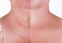 Yanaktaki çizgi, gözaltındaki torba uçup gidecek! Cilt dokusunu yenileyen vitamin