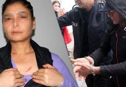 Cani komşudan ölüm düzeneği! Kapının önünden geçmesini bekledi: Kalbimi hedef aldı