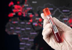 Fransa'da M çiçeği alarmı!  Virüsünün yeni varyantı ilk kez tespit edildi