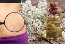 Avusturalyalılar asırlardır vazgeçemedi! Çatlak çizgilerini yok ediyor, doğal kurtarıcı