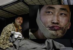 Zelenskiy'den Kim'e esir askerlerle ilgili teklif!