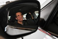 Türkiye'de bir ilk oldu! Önce yüzü, sonra hayatı değişti: Çocukken toplumun içine çıkmaya çekiniyordum