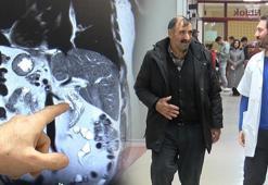 Dünyada 47'nci, Türkiye'de 2'nci vaka! Gerçeği 1999 yılında öğrendi, geçen hafta hastaneye koştu