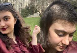 10 yıldır saçlarını yolup köklerini yiyor! 'Siyah noktayı çıkartmışım gibi rahatlatıcı bir his'