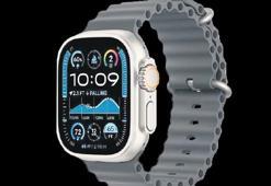 Saat kayışlarının zehirli kimyasal içerdiği iddia ediliyor! ‘Apple Watch’a kanser davası