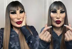 Lyn May değişimiyle bambaşka biri oldu! Yüzüne yaptırdığı işlemler şoke etti