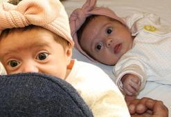 Prematüre doğdu, 1 haftalıkken teşhis kondu! Miray bebeğin 1 milyon 870 bin dolara ihtiyacı var