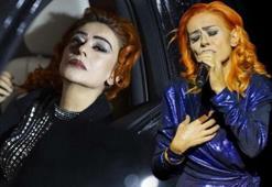 Yıldız Tilbe'nin yüzü yanmıştı! Günler sonra açıkladı: Neler yaşadı?