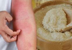 Kaşıya kaşıya yara olan cilde birebir! 15 dakikada yatıştırıyor, üstelik doğal